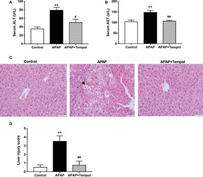 Tempol Protects Against Acetaminophen Induced Acute Hepatotoxicity by Inhibiting Oxidative Stress and Apoptosis